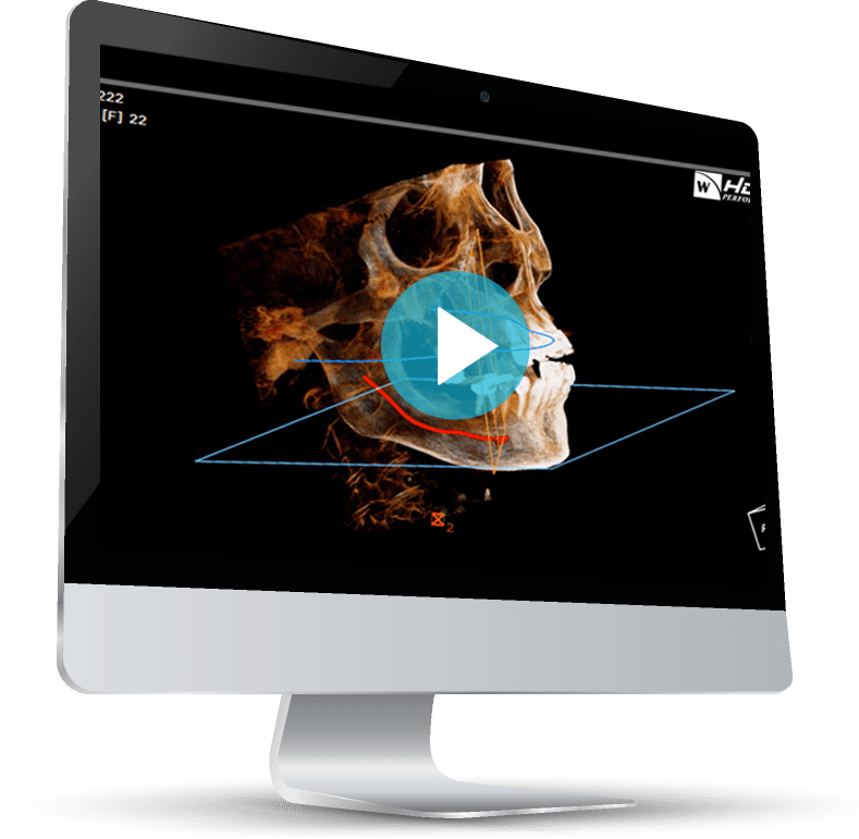 onDemand3D Video