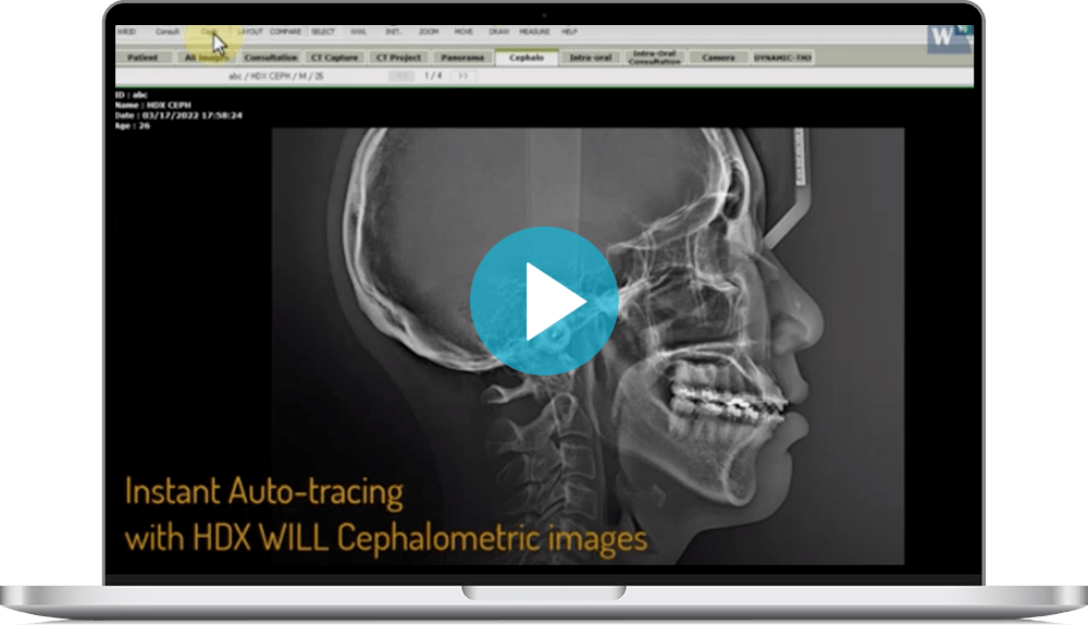 Will Ceph Video